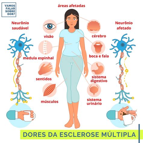 qual a causa da esclerose multipla